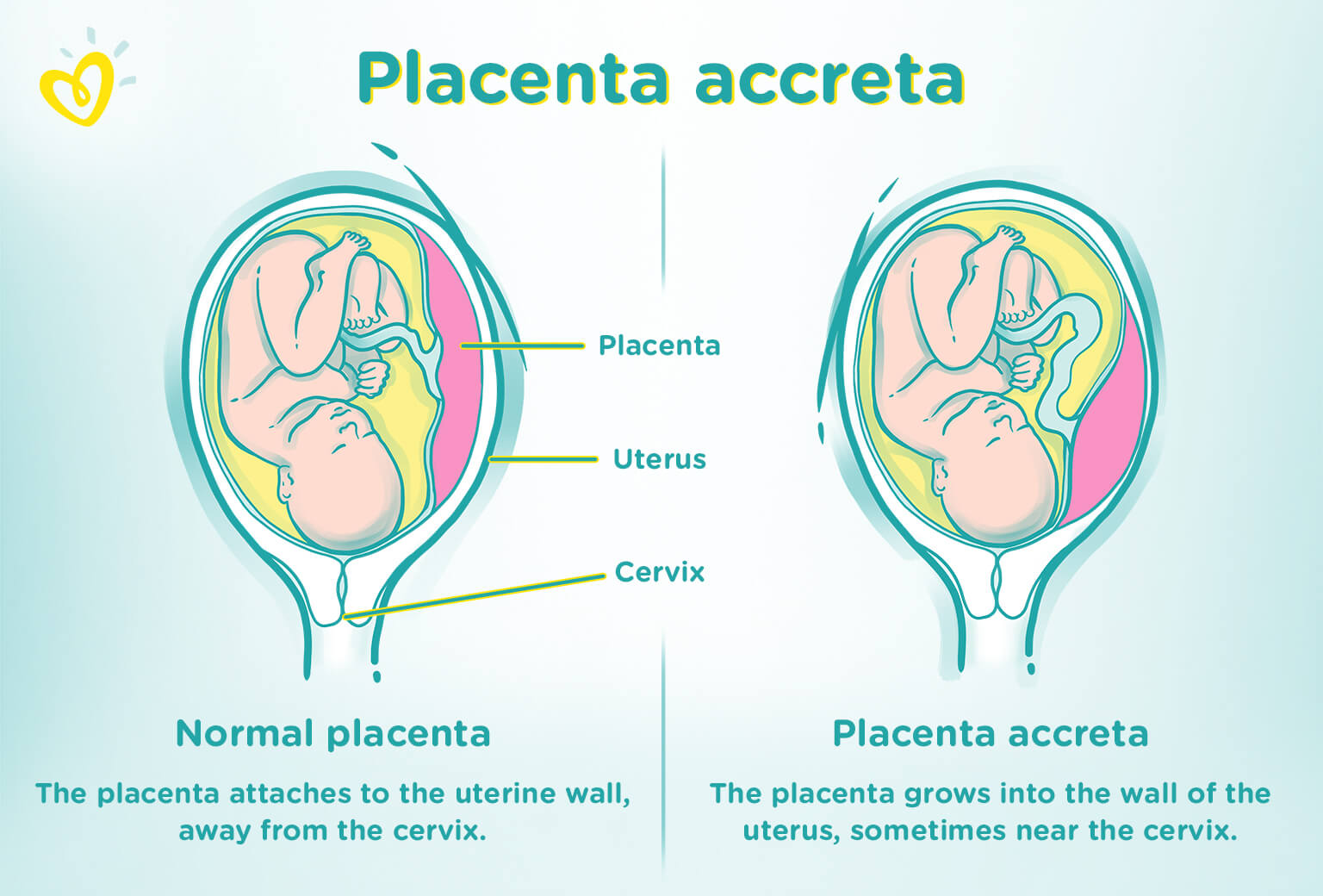 The Truth About Placenta Supplements: What You Need to Know